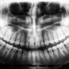 Essential Things to Know about Vaping & Oral Health - What to Know